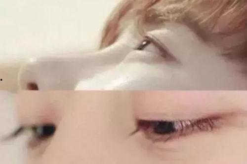 昆明睫毛吃瓜,揭秘网红美食背后的“吃瓜”故事